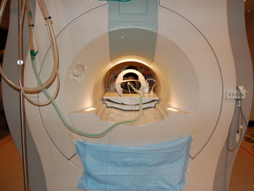 Pepper_in_mri Pepper_in_mri