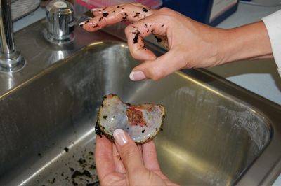 Brenda holding Teddy's gallbladder